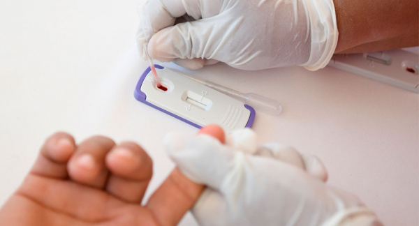 Cada-cuánto-se-debe-realizar-la-prueba-del-VIH